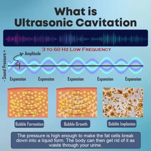 CZTICLE™ Ultrasonic Fat Blasting